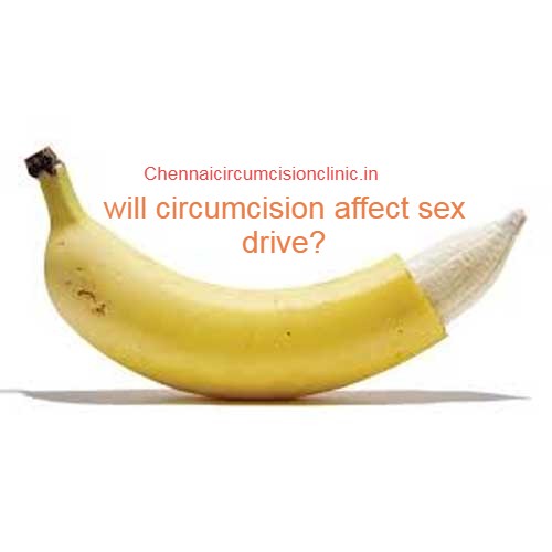 circumcision-clinic-specialist