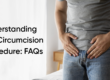 Circumcision Procedure: FAQs