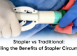Stapler vs Traditional Circumcision